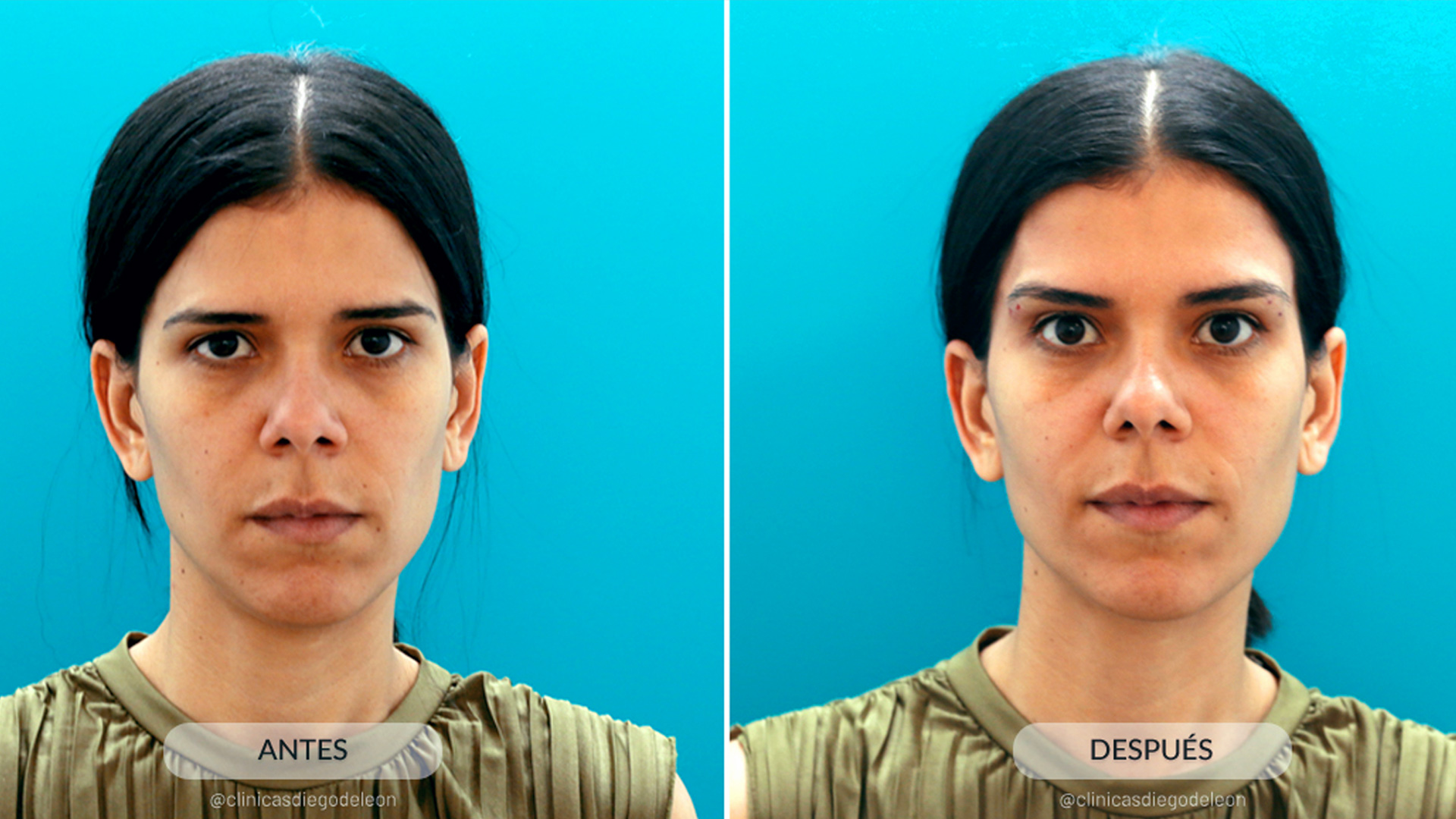 total eyes resultados