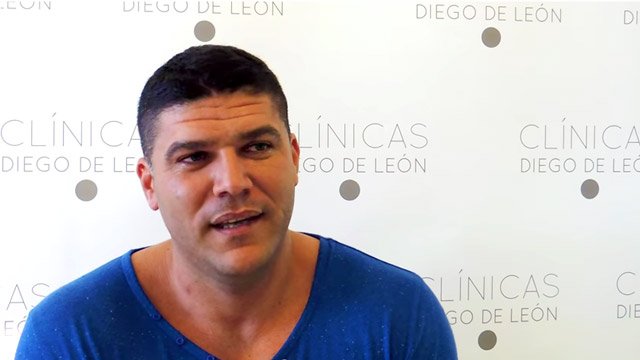 Operación de ginecomastia Manuel