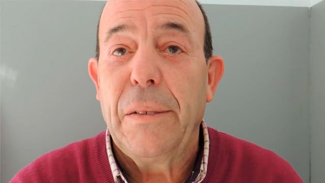 Blefaroplastia hombres: Quintín