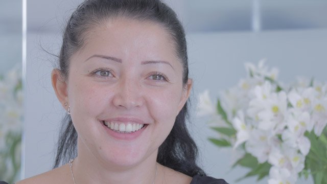 Implante de Mentón Antes y Después Mihaela