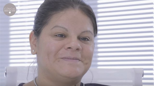 Balón Gástrico Claudia