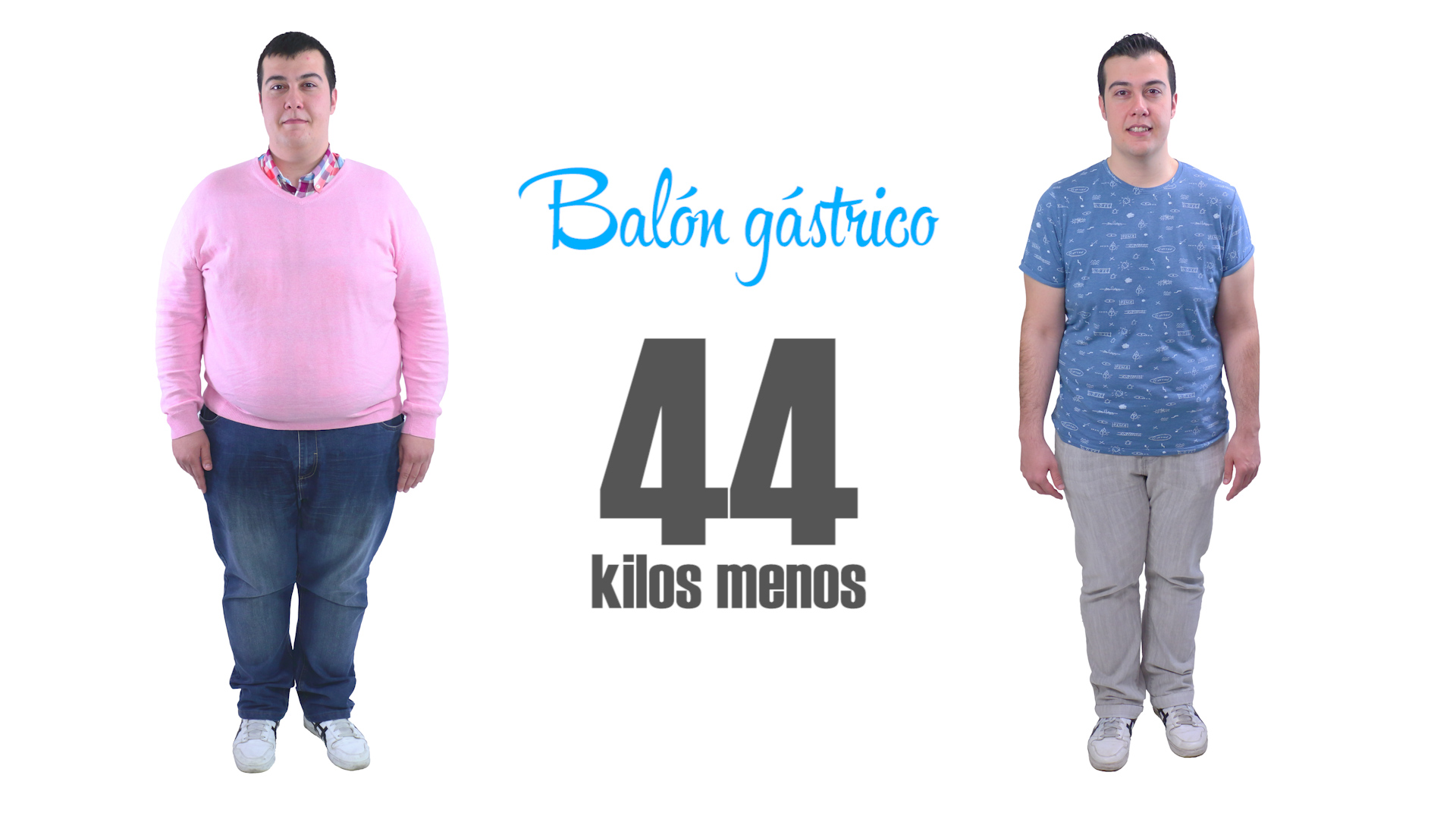 Balón gástrico: experiencia de Iván