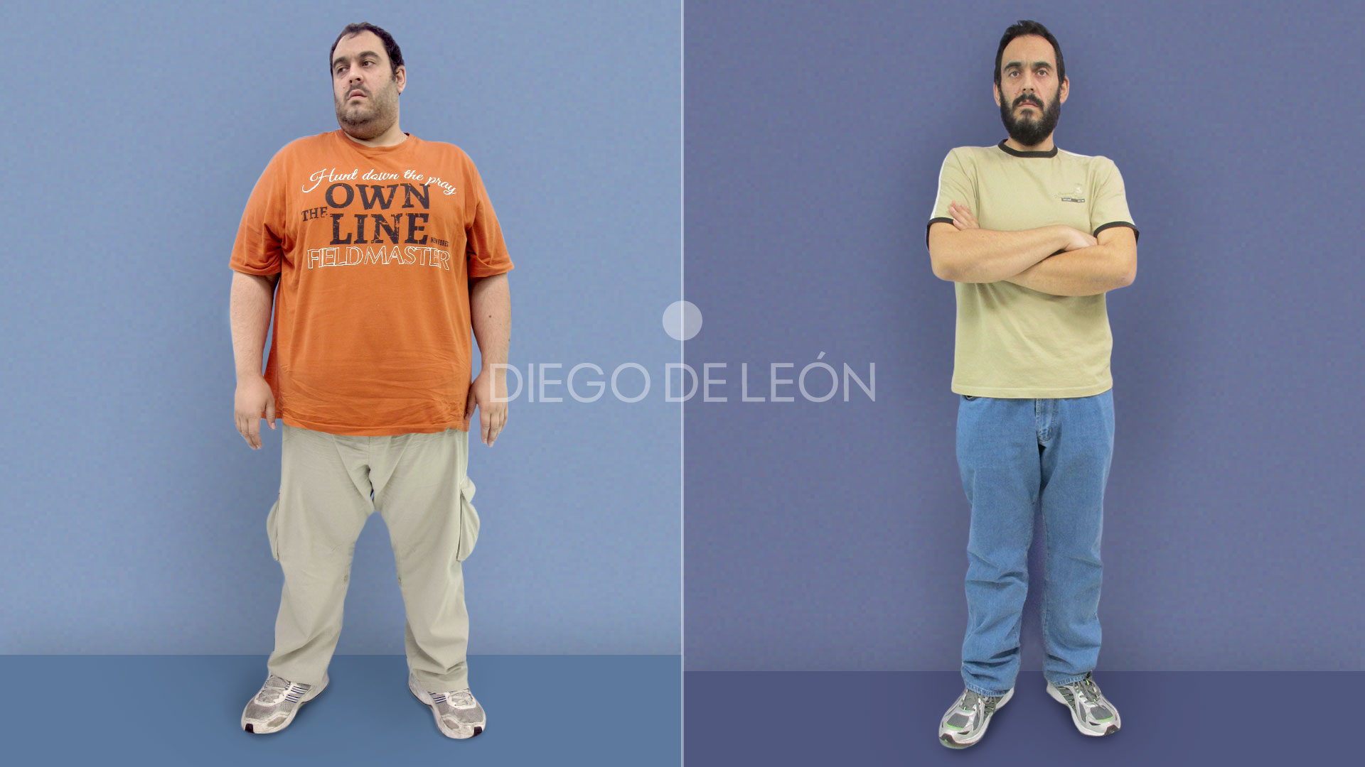 Bypass gástrico: testimonio del antes y después