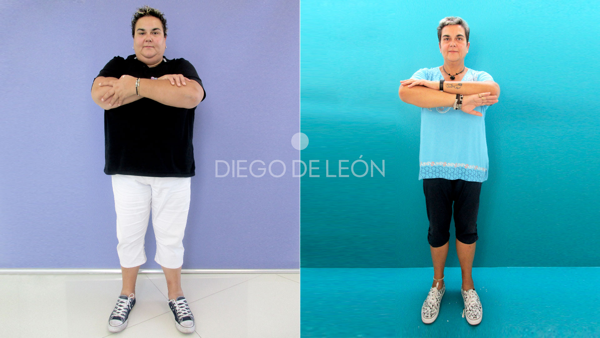 Perder peso con Manga Gástrica | Testimonio