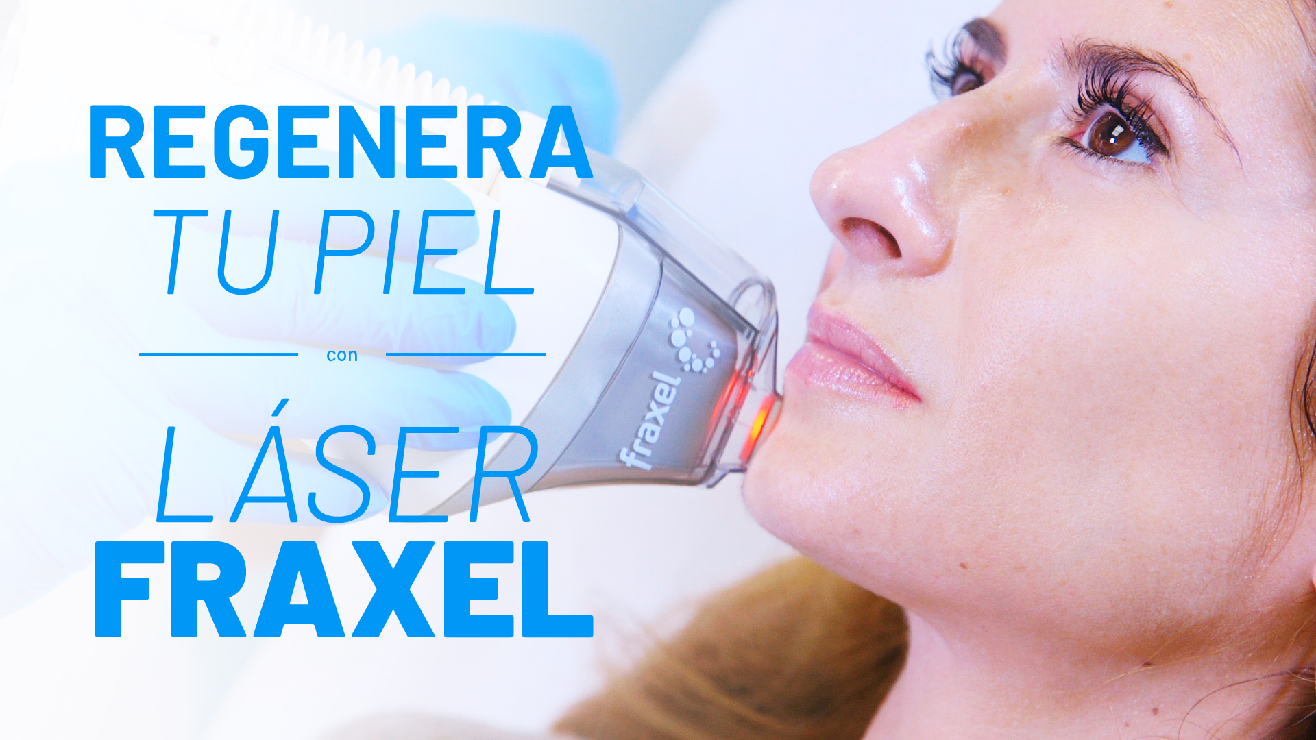 A Trendy Life prueba el Láser Fraxel Dual en la zona facial