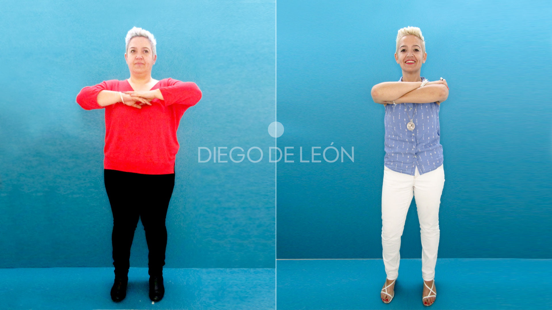 Perder 50 kg es posible gracias a la Reducción de Estómago [Testimonio]