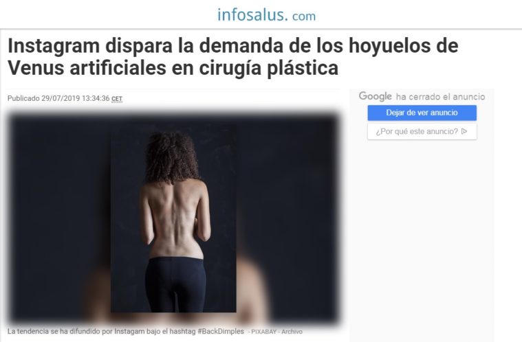 Cirugía plástica para hoyuelos de venus