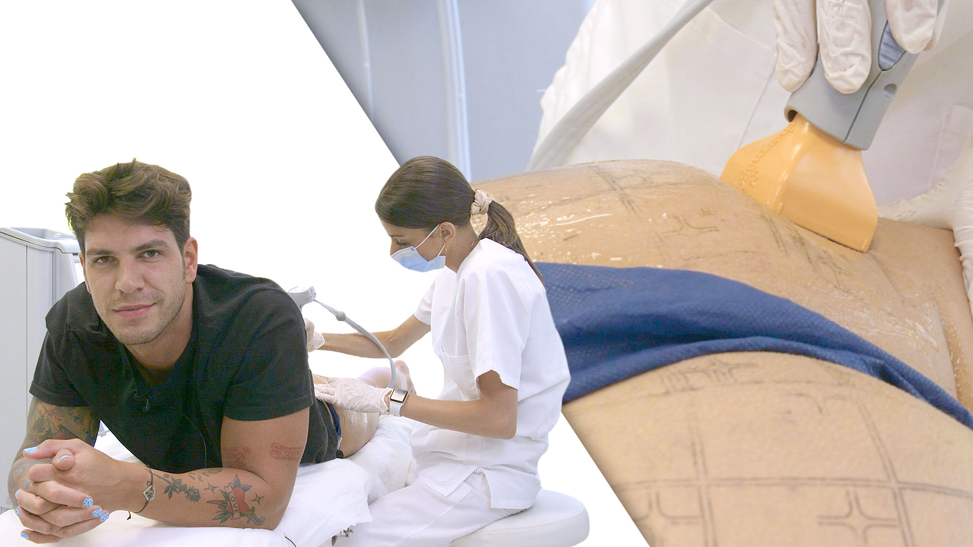 Diego Matamoros se atreve con el “Efecto Push Up” para elevar los glúteos