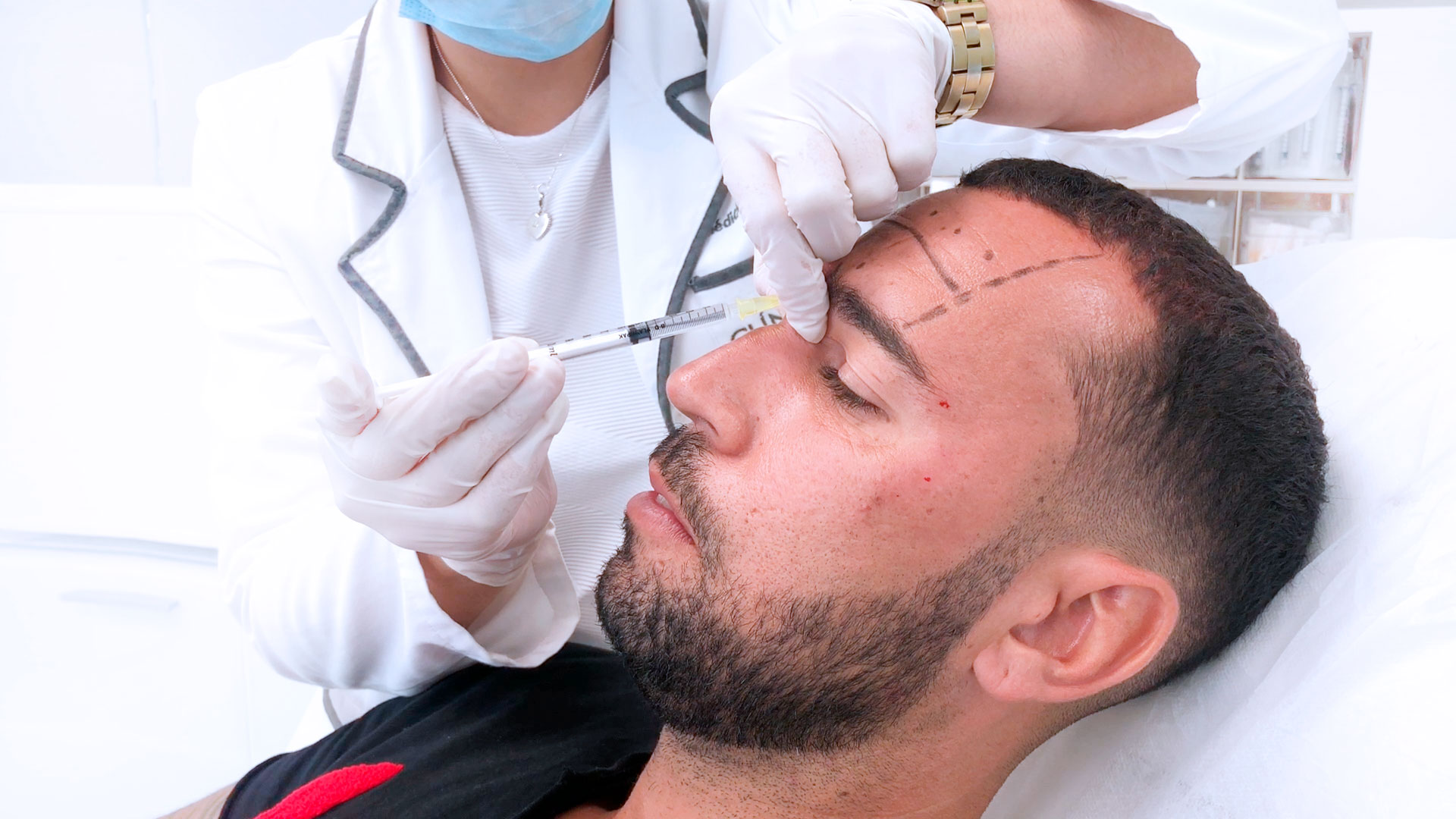 ¿Qué se ha hecho Omar Sánchez antes de embarcarse en Supervivientes?: Te lo contamos todo