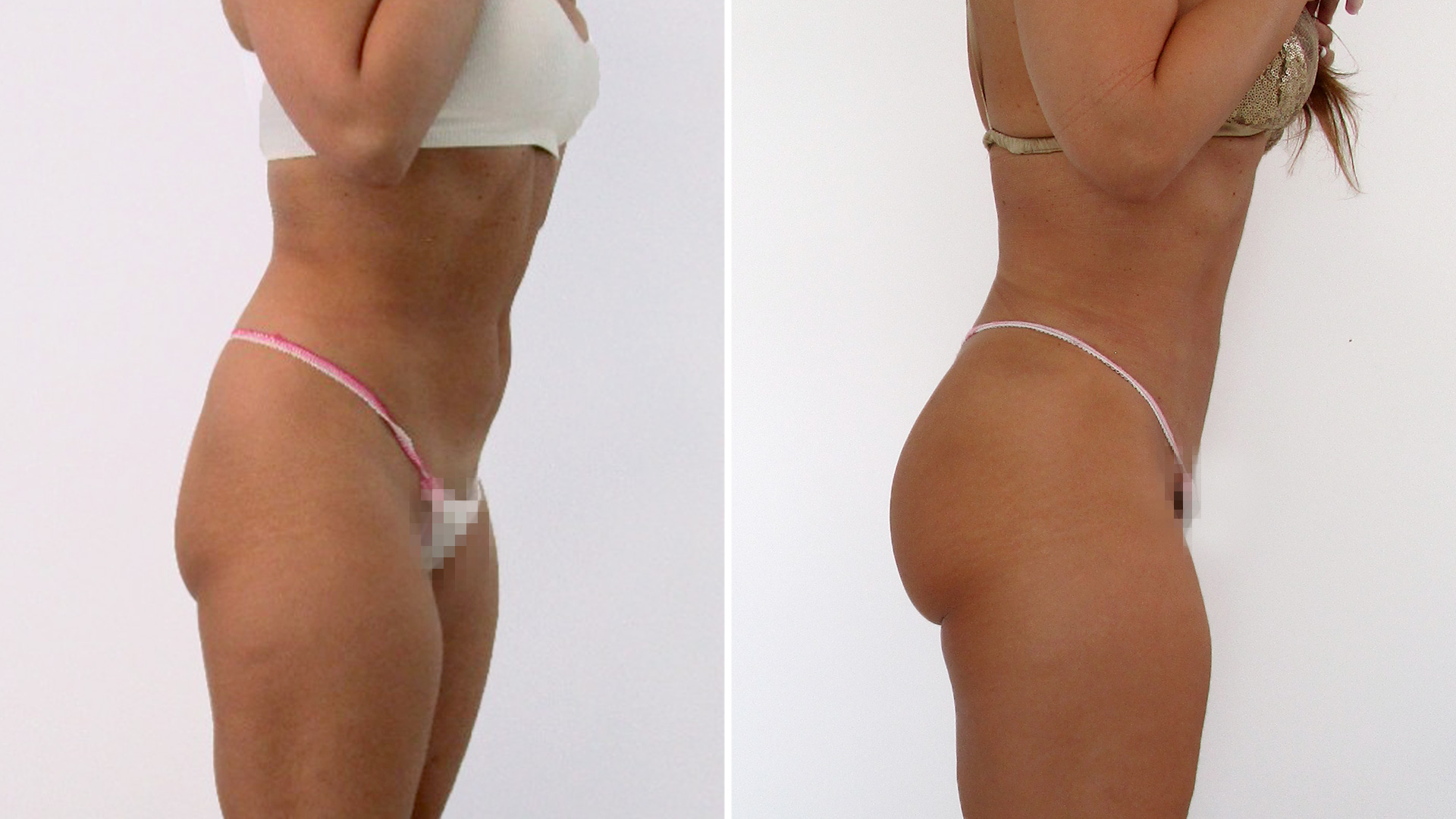 Amaya tras su remodelación 360: “He recuperado la confianza, me siento a gusto conmigo misma y eso es impagable”