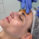 Peeling: Beauty Reset