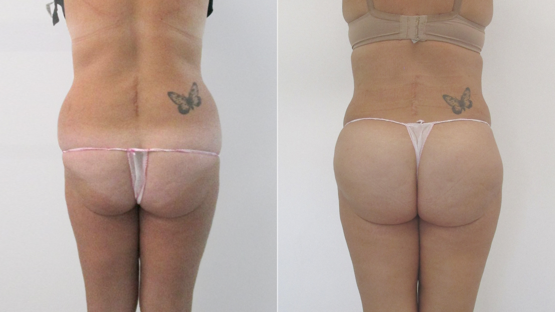 Almudena, después de su remodelación corporal 360: “Antes estaba amargada y ahora soy feliz”