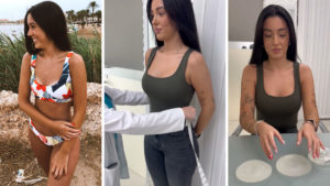 María: “Con este diseño de escote he recuperado mi confianza frente al espejo”