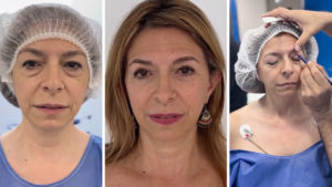 La nueva mirada de María Elena: “He quedado tan bien que ni necesito maquillarme”